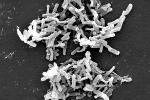 An electron microscope image of the bacteria Clostridium difficile
